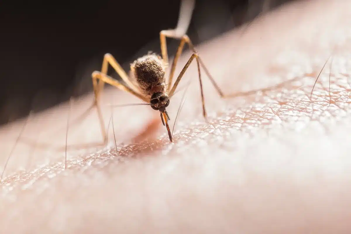 Éruption cutanée et symptômes de dengue sur la peau