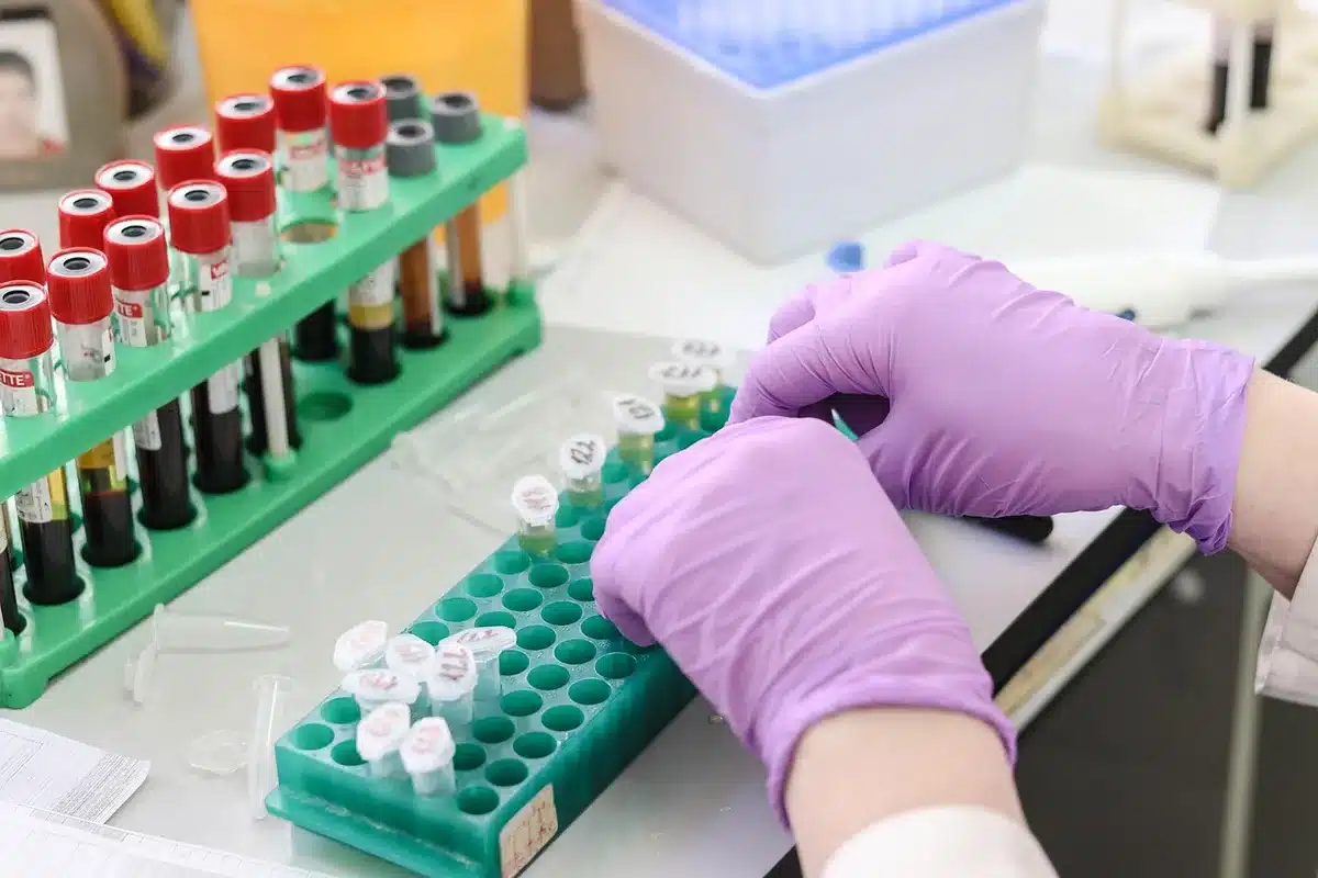 Gros plan d'un écran montrant une séquence génétique et des données de laboratoire sur FOXP3